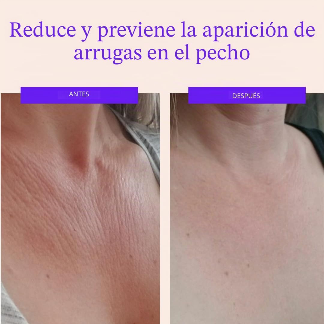 Almohadilla Antiarrugas para Escote - Silicona Reutilizable para Arrugas del Pecho - Prevenir y Eliminar Arrugas de Piel - Reafirmante, Tonificante, Más Natural Alternativa al Botox (Para 2 mes)