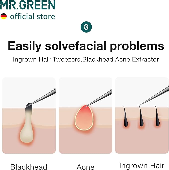 MR.GREEN Ingrown Hair Tweezers Needle Nose Pointed Tips