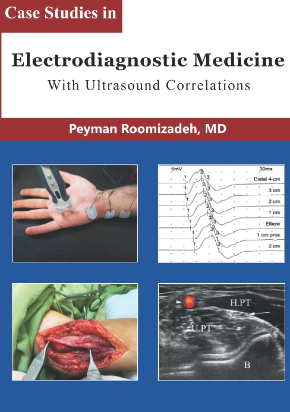 Case Studies in Electrodiagnostic Medicine: With Ultrasound Correlations