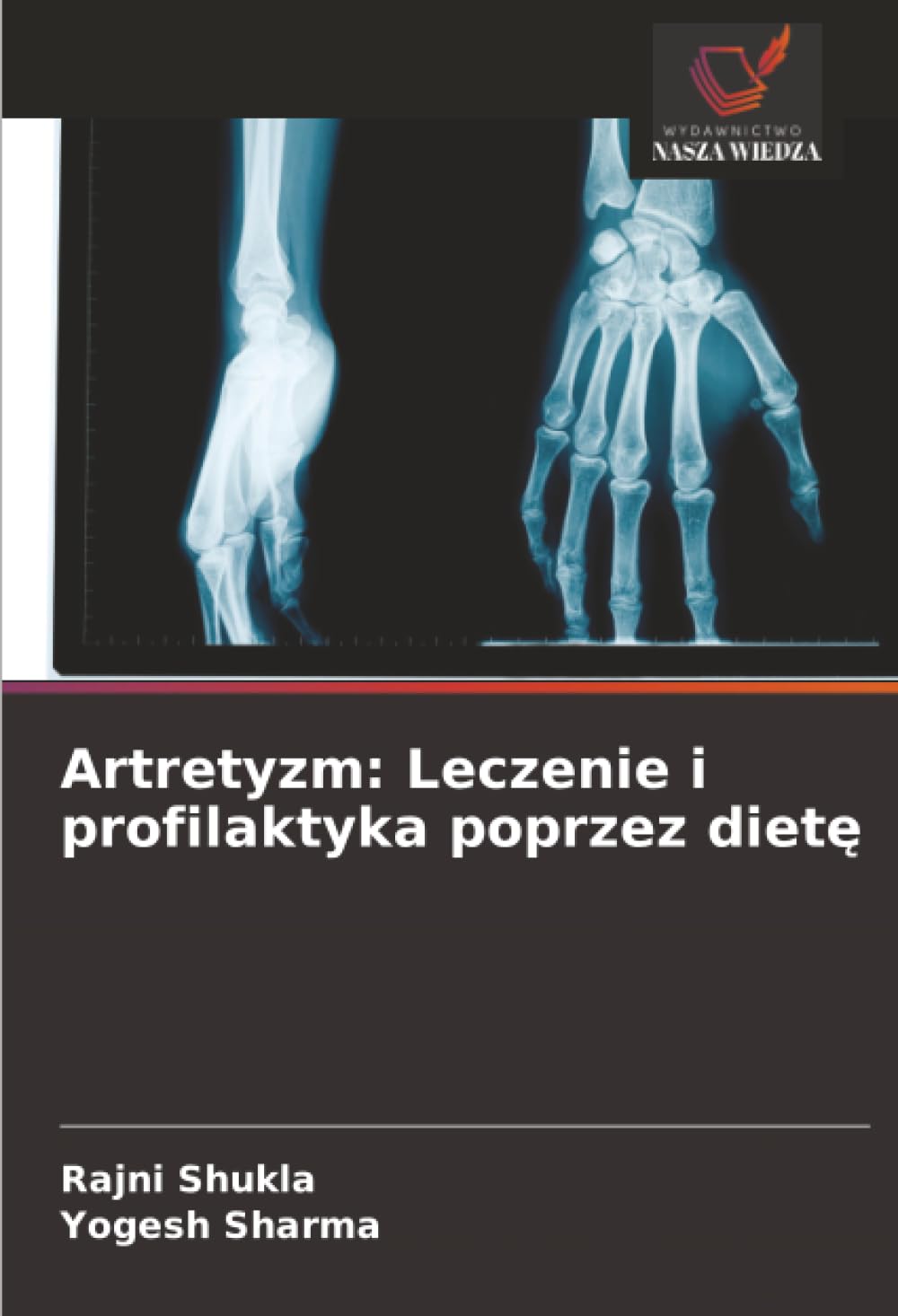 Artretyzm: Leczenie i profilaktyka poprzez diet¿