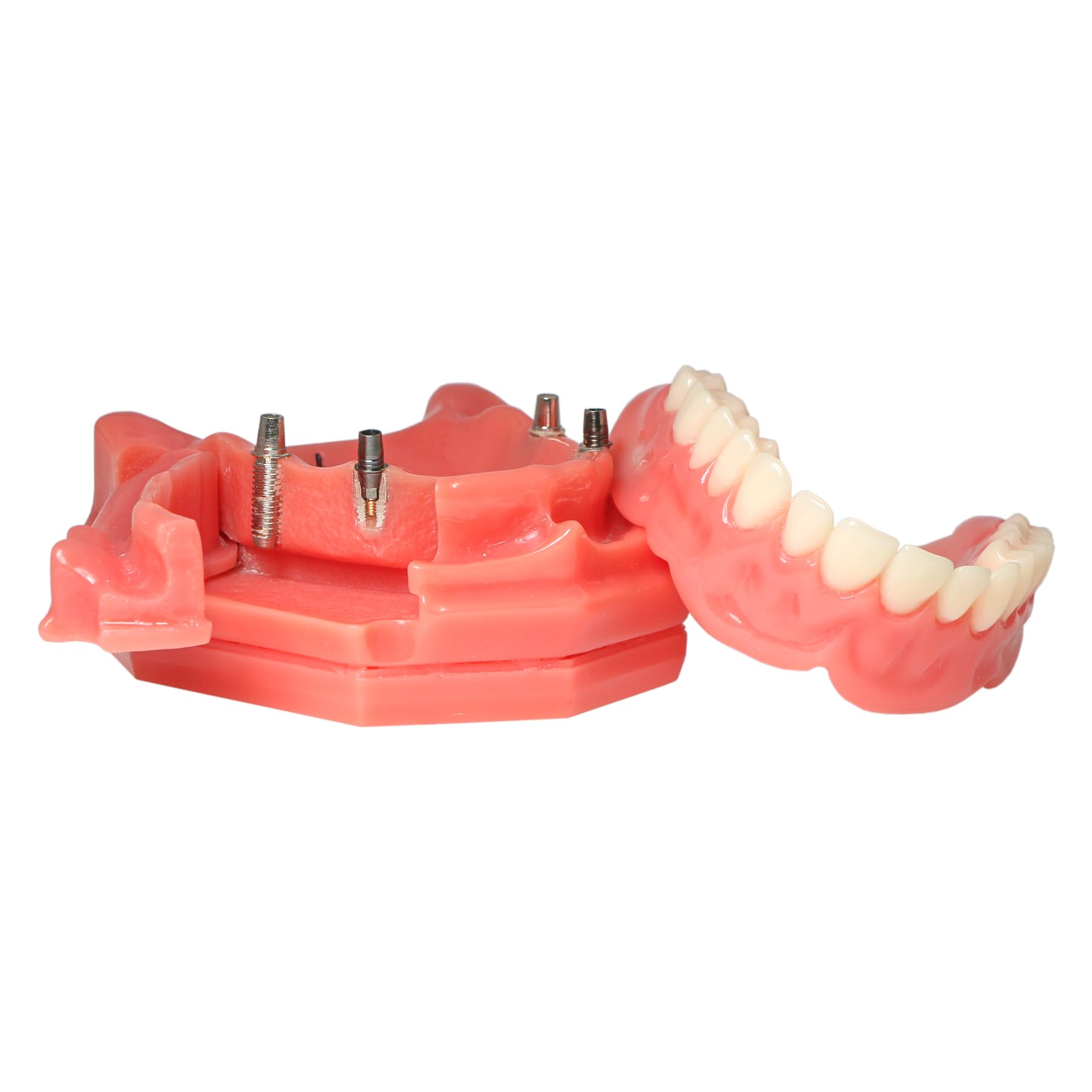 Dental Overdenture Implant Teeth Typodont Model with Jaw and 4 Screws