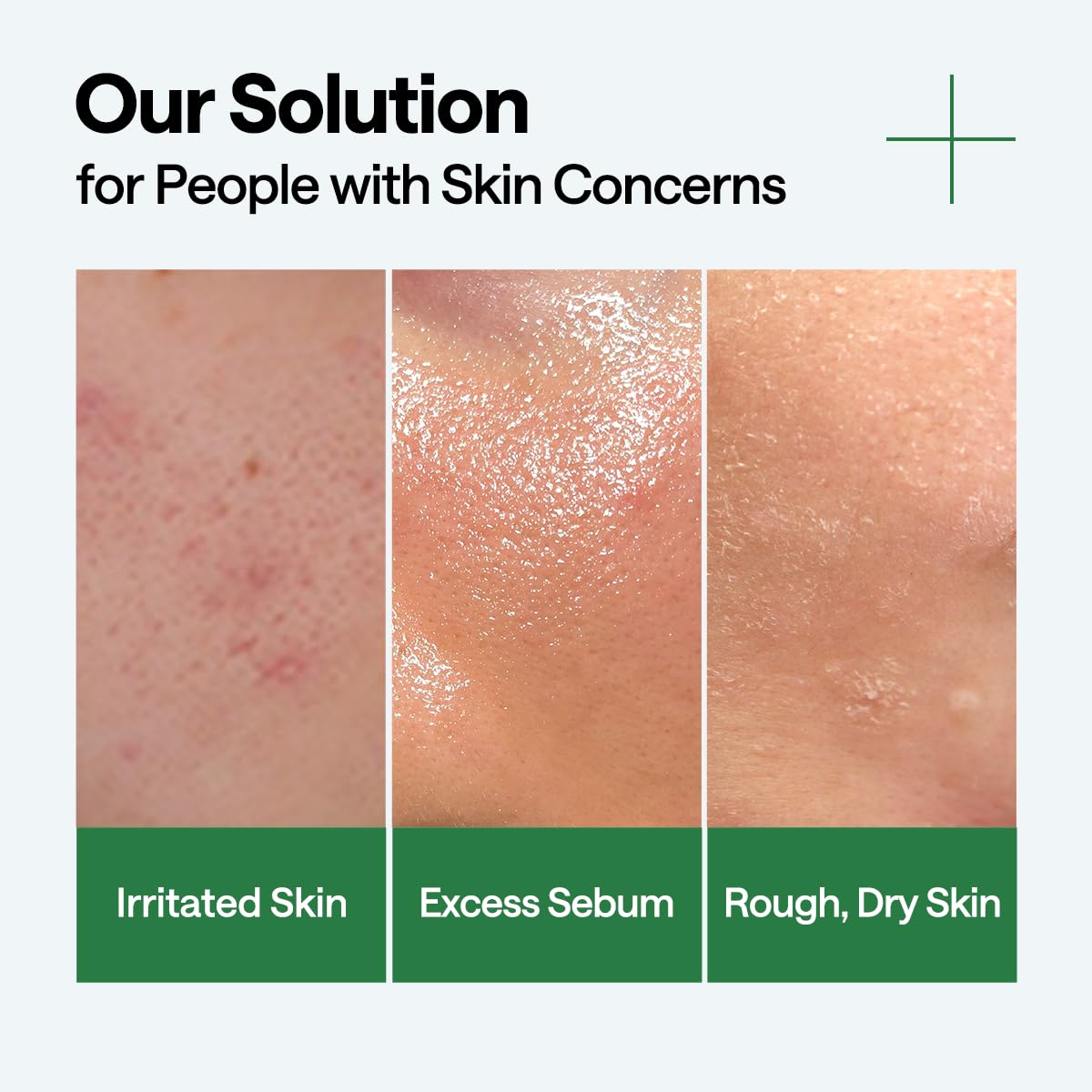 Mediheal Teatree Calming Serum 1.35 fl.oz - Quick Skin Calming and Redness Relief - Sebum Care, Oil Moisture Balance & Deep Moisturization with Hyaluronic Acid - Image 4