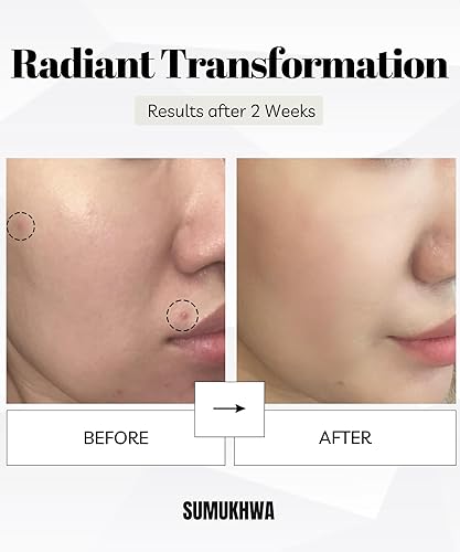 Miniatura 3 de Miracle Snail Mucin 97 Korean Skincare, gran tamaño 5.1 fl oz, suero de mucina de caracol con filtrado de secreción de caracol 97% y 8 ácidos