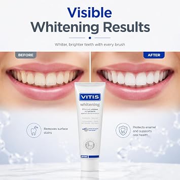 Vitis Whitening Toothpaste 100ml
