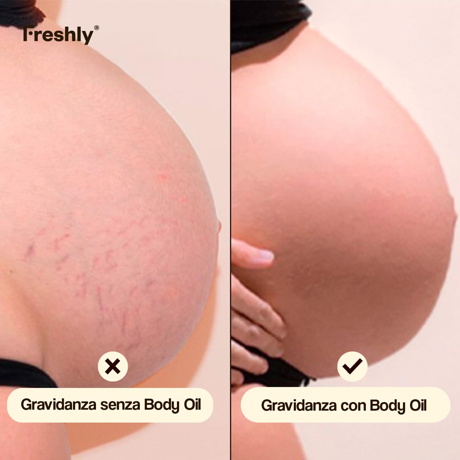 Freshly - Olio Corpo Naturale Golden Radiance - Idratante e Rassodante - Con 12 Oli Vegetali - Ideale per Smagliature e Cicatrici - Adatto in Gravidanza - 100 ml