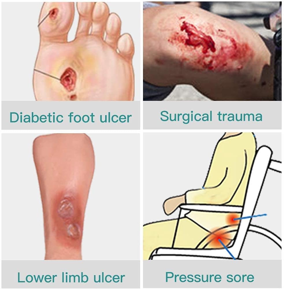 Dimora Calcium Alginate Wound Dressing with Silicone Wound Contact Layer