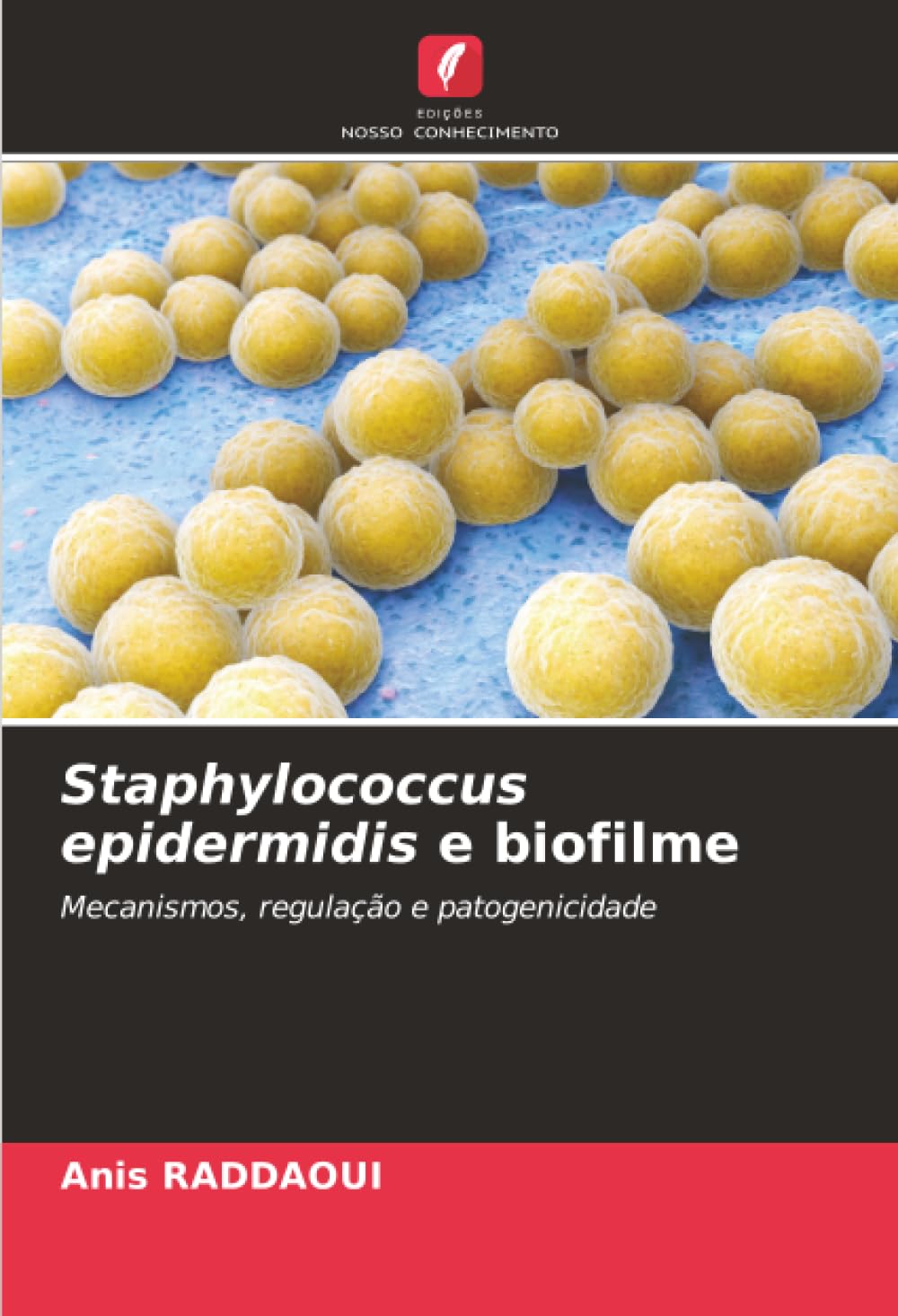 Staphylococcus epidermidis e biofilme: Mecanismos, regulação e patogenicidade
