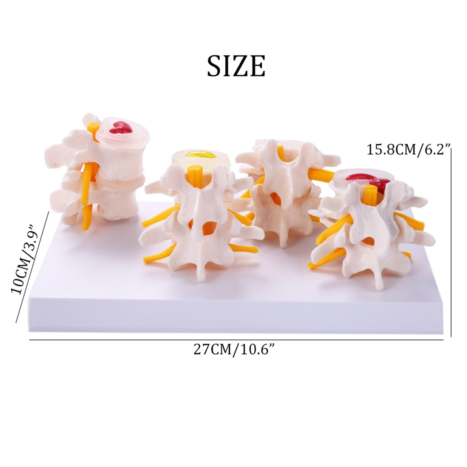 Modele anatomiczne Anatomia człowieka Szkielet Kręgosłup 4-etapowy Model Kręgów Lędźwiowych Mózg Czaszka Uraz Do Medycznych Materiałów Dydaktycznych Medyczne Narzędzie Dydaktyczne
