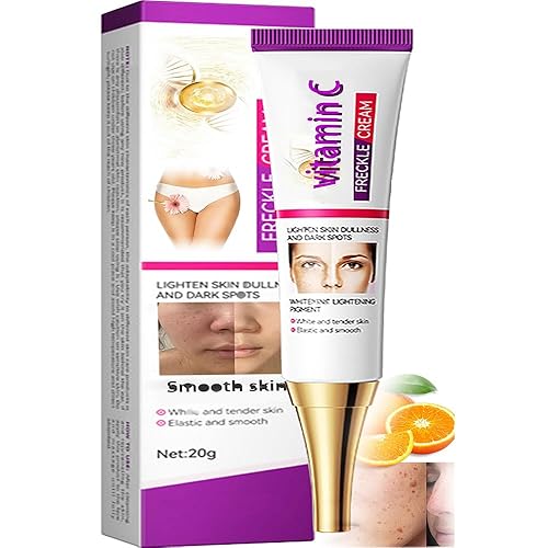 Removedor de manchas oscuras para rostro, crema de niacinamida Manchas Oscuras, 0.71 oz Crema Premium Manchas Edad, manchas oscuras en manos,