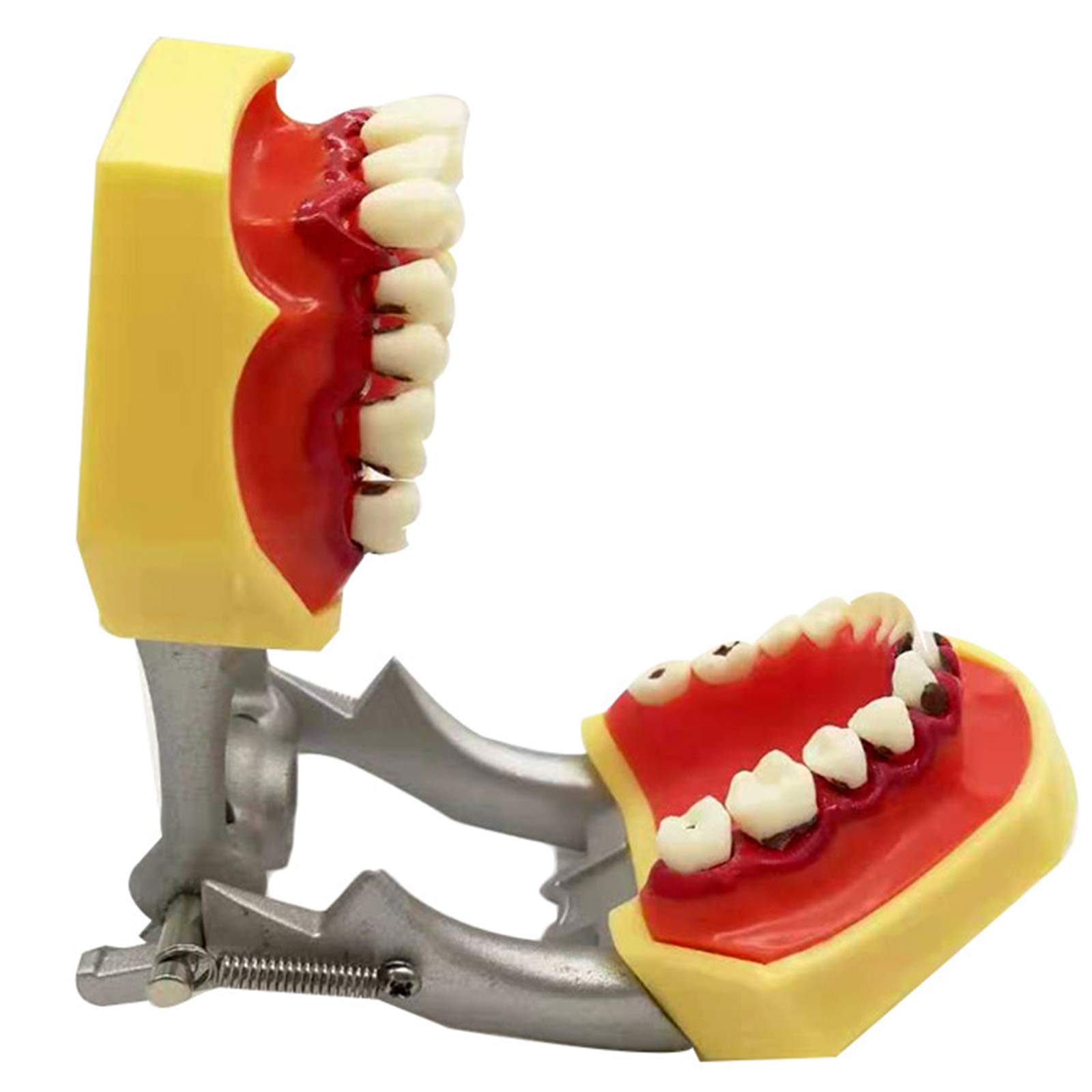 Sjdopulse A Pathologies Teeth Model - Teeth Teaching Model - Dental Implant Study Nalysis Demonstration - Standard Dult Pathologies Periodontal Model - For Study Teaching (A)