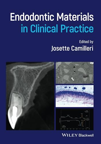 Endodontic Materials in Clinical Practice
