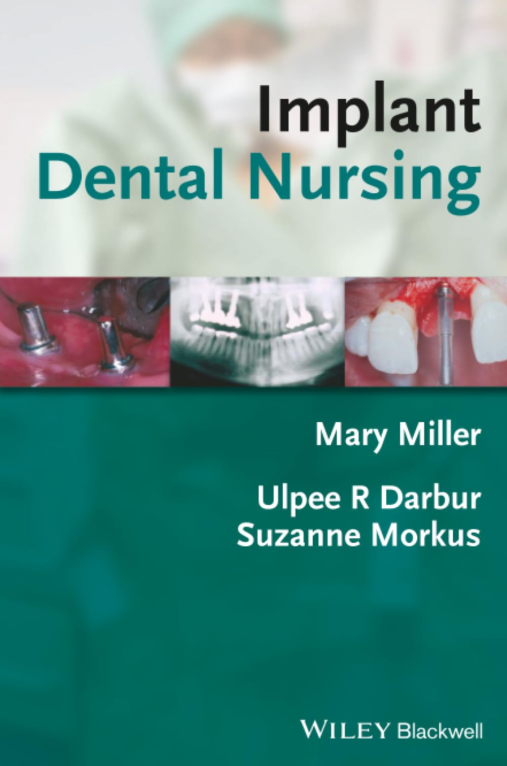 Implant Dental Nursing Miller Paperback Wiley–Blackwell 9781405144285