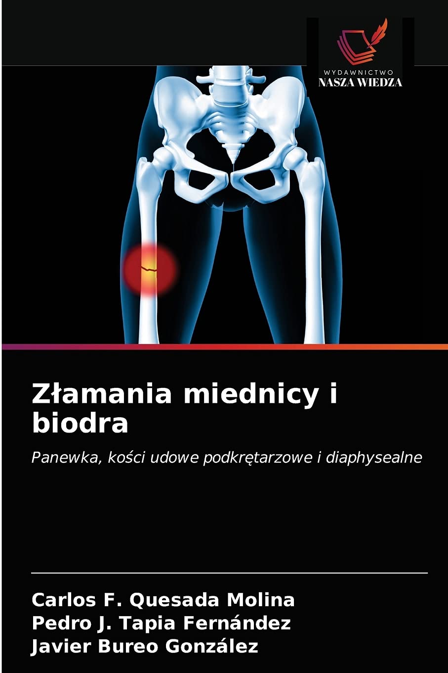 Złamania miednicy i biodra