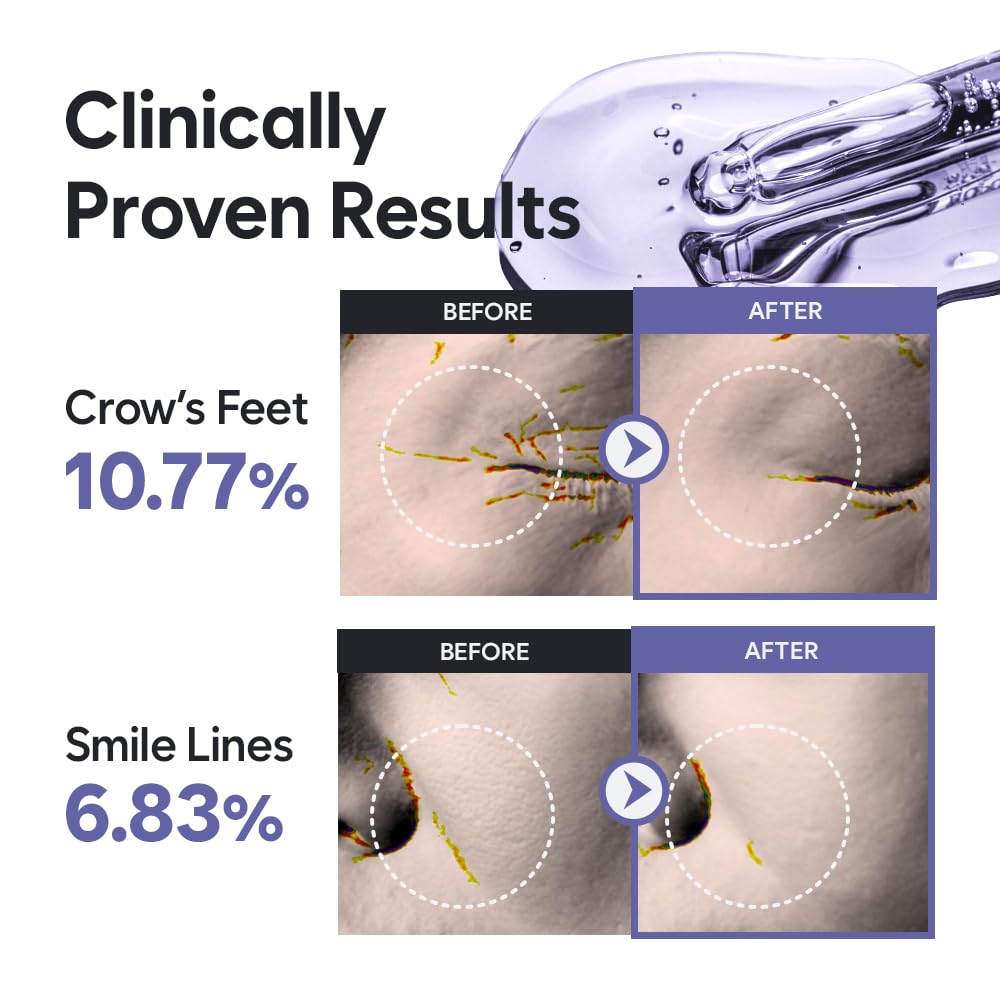 HAUA Bionymph Peptide Youth Serum, Wrinkle Care, Well-aging, Anti-aging, Fine lines, Deep Hydration, Patented BioNymph Peptide, Valentine's Day Gifts for Woman | 47ml - Image 3