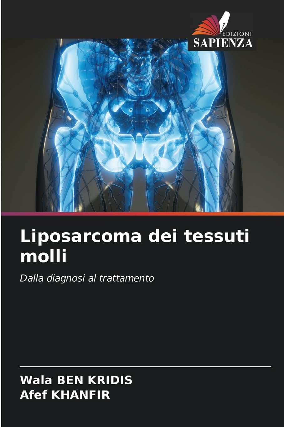 Liposarcoma dei tessuti molli: Dalla diagnosi al trattamento