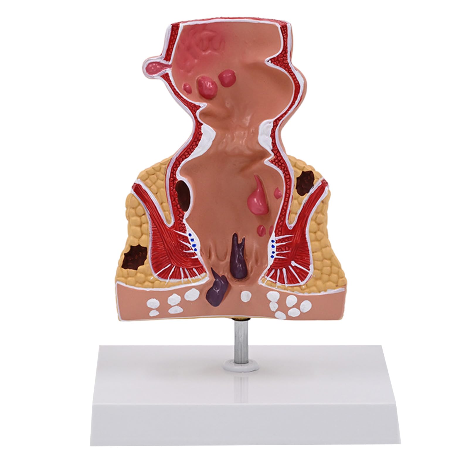 XuQiZZpp Human Rectum Model for Anatomy Teaching Aid Practical Human Pathologies of Rectum Model School Supplies
