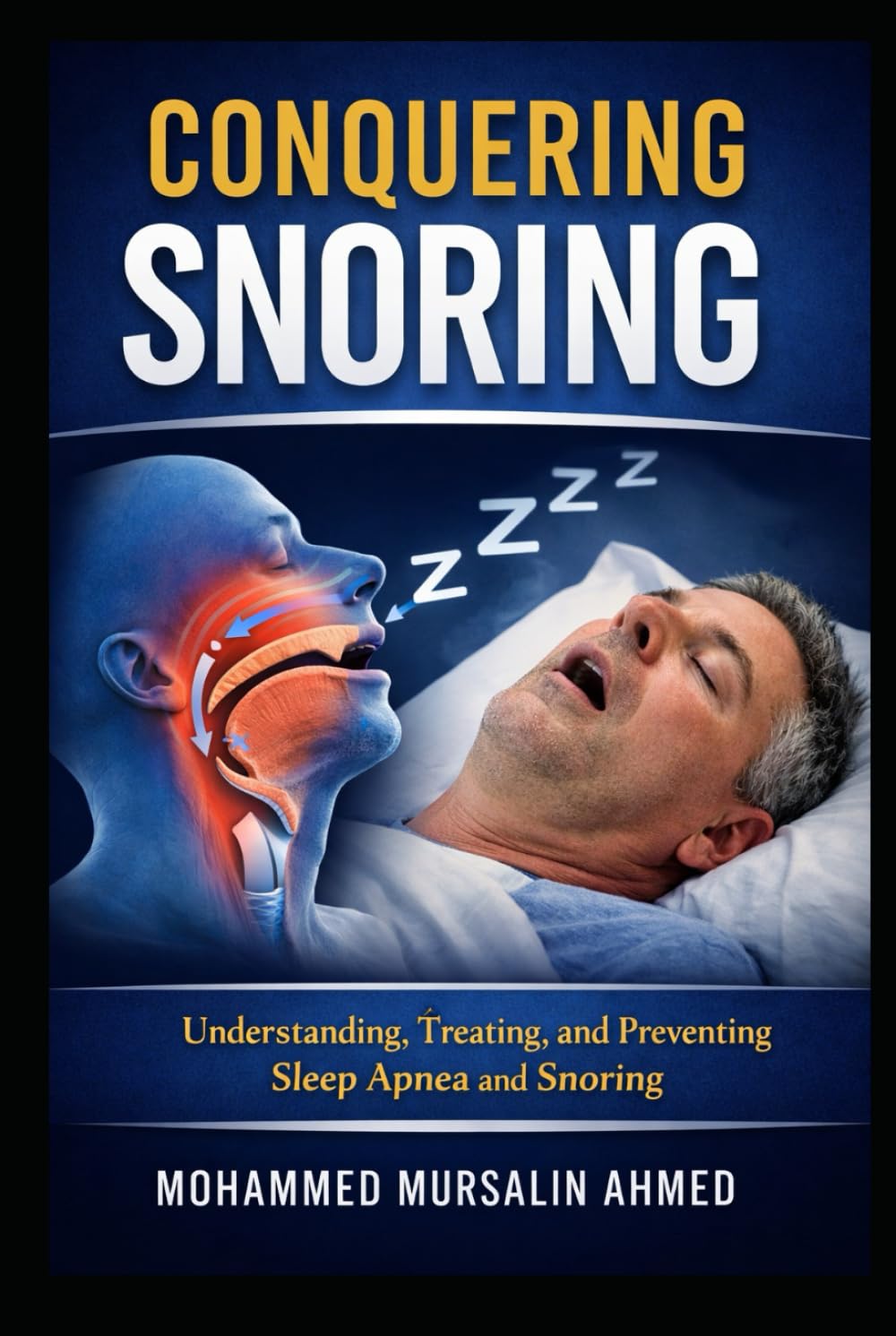 Conquering Snoring: Understanding, Treating, and Preventing Sleep Apnea and Snoring