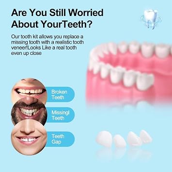 6PCS Veneers Teeth for Women,Tooth Repair Kit,Tooth Replacement Missing Teeth,Temporary Tooth Filling,Fake Teeth & False Teeth Set for Top and Bottom,Moldable Dental Retainers with Thermal Beads