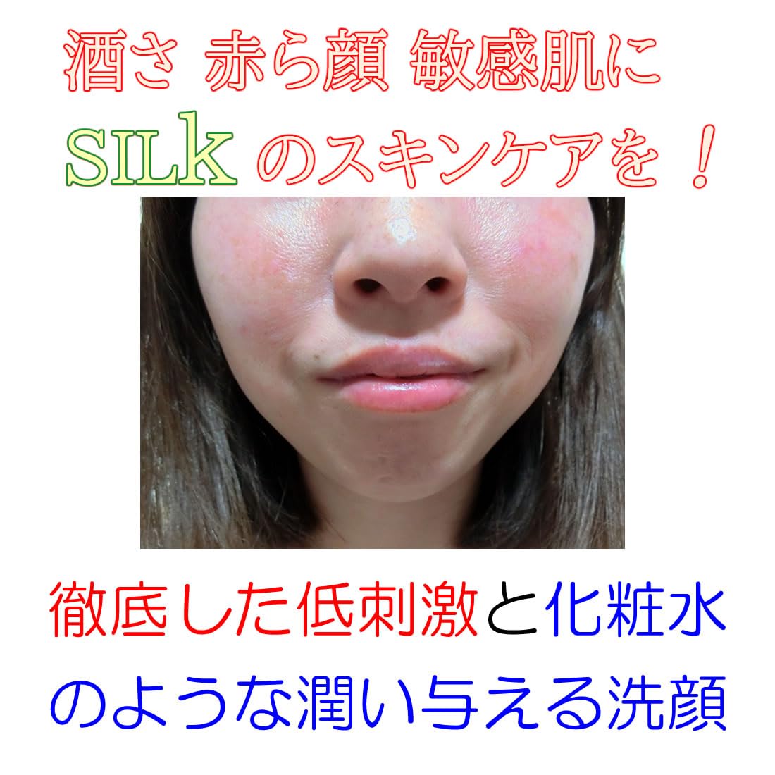 Amazon | SILK 酒さ クレンジング 水溶性ジェル 界面活性剤不使用