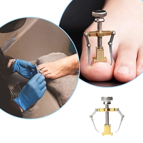 Miniatura 3 de Ingrown Toenail Corrector Professional Ingrown Toenail Lifter Practical Toe Clamp for Ingrown Toenail Treatment