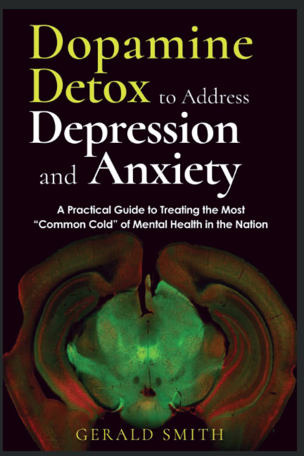 Dopamine Detox to Address Depression and Anxiety: A Practical Guide to treating the most “common cold” of mental health in the nation