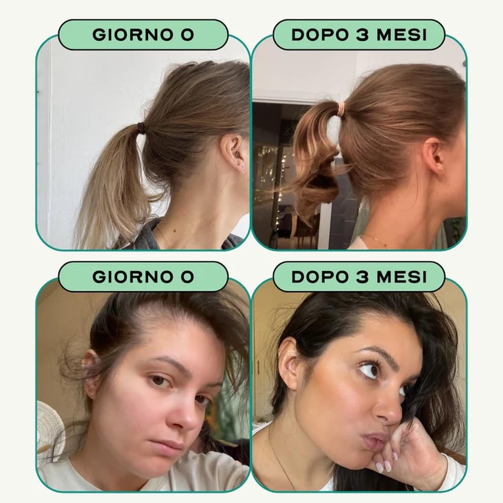Circles GROW – Integratore Anti Caduta e Ricrescita Capelli Donna | Biotina, Saw Palmetto, Equiseto, Ferro | Capelli e Unghie | Senza Zuccheri né Edulcoranti | 30 Capsule