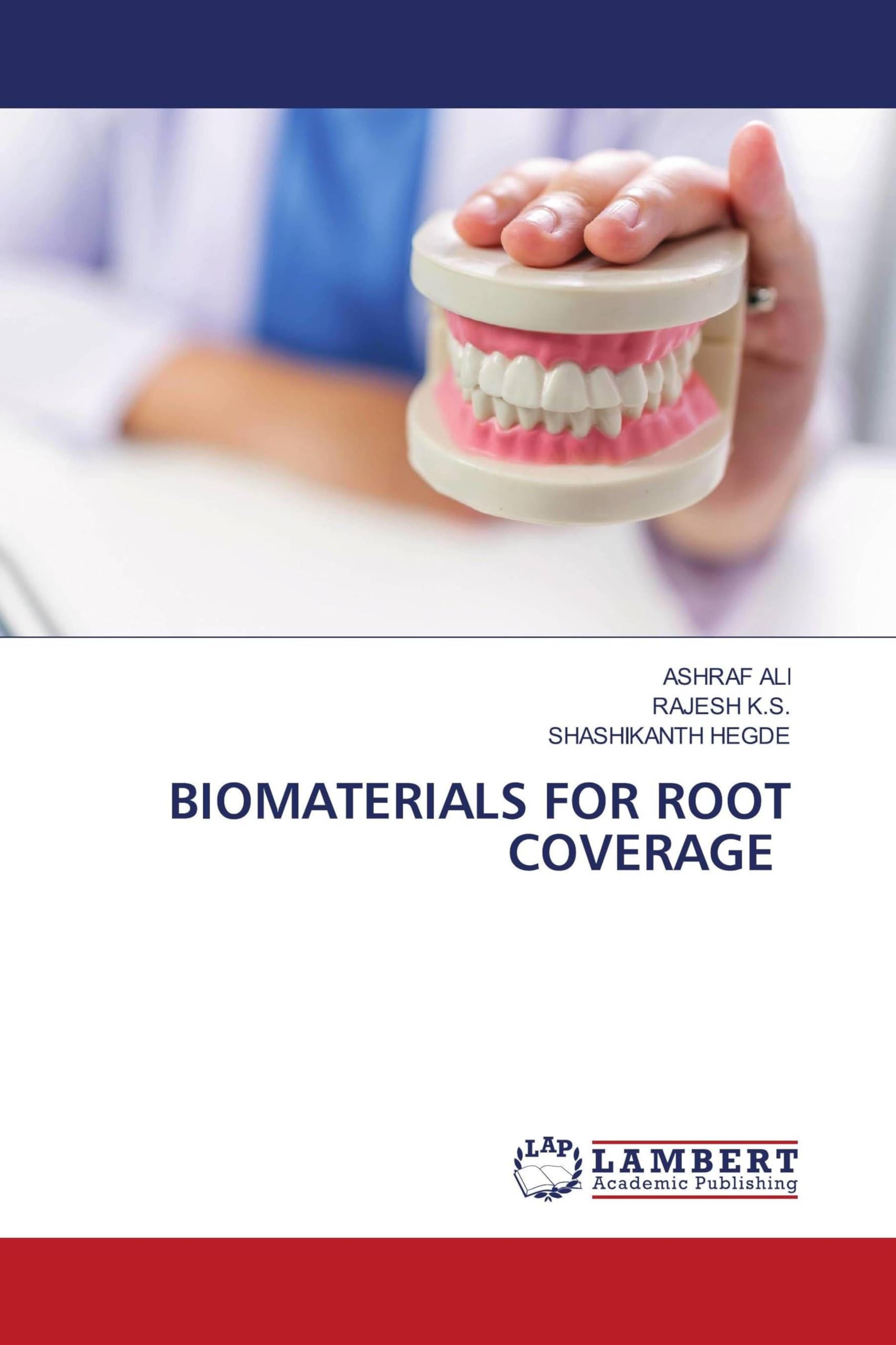 Biomaterials for Root Coverage: Systematyczna analiza literatury