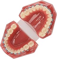 Vista 4 de Modelo de cuidado de dientes, 28 piezas de resina de dientes enseñanza con soportes de metal, modelo de dientes para estudiantes, modelo de dientes