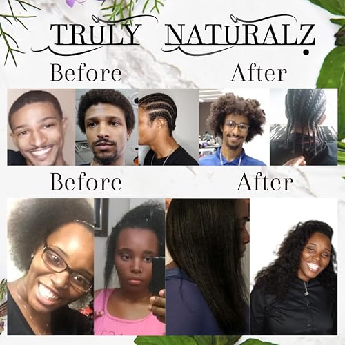 Miniatura 3 de Grasa natural de crecimiento rápido, ideal para el crecimiento del cabello, pérdida de cabello, caspa