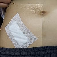 Vista 6 de Tondiamo Protector de ducha de diálisis peritoneal, cinturón de diálisis peritoneal, impermeable, transparente, cinta de vendaje para natación