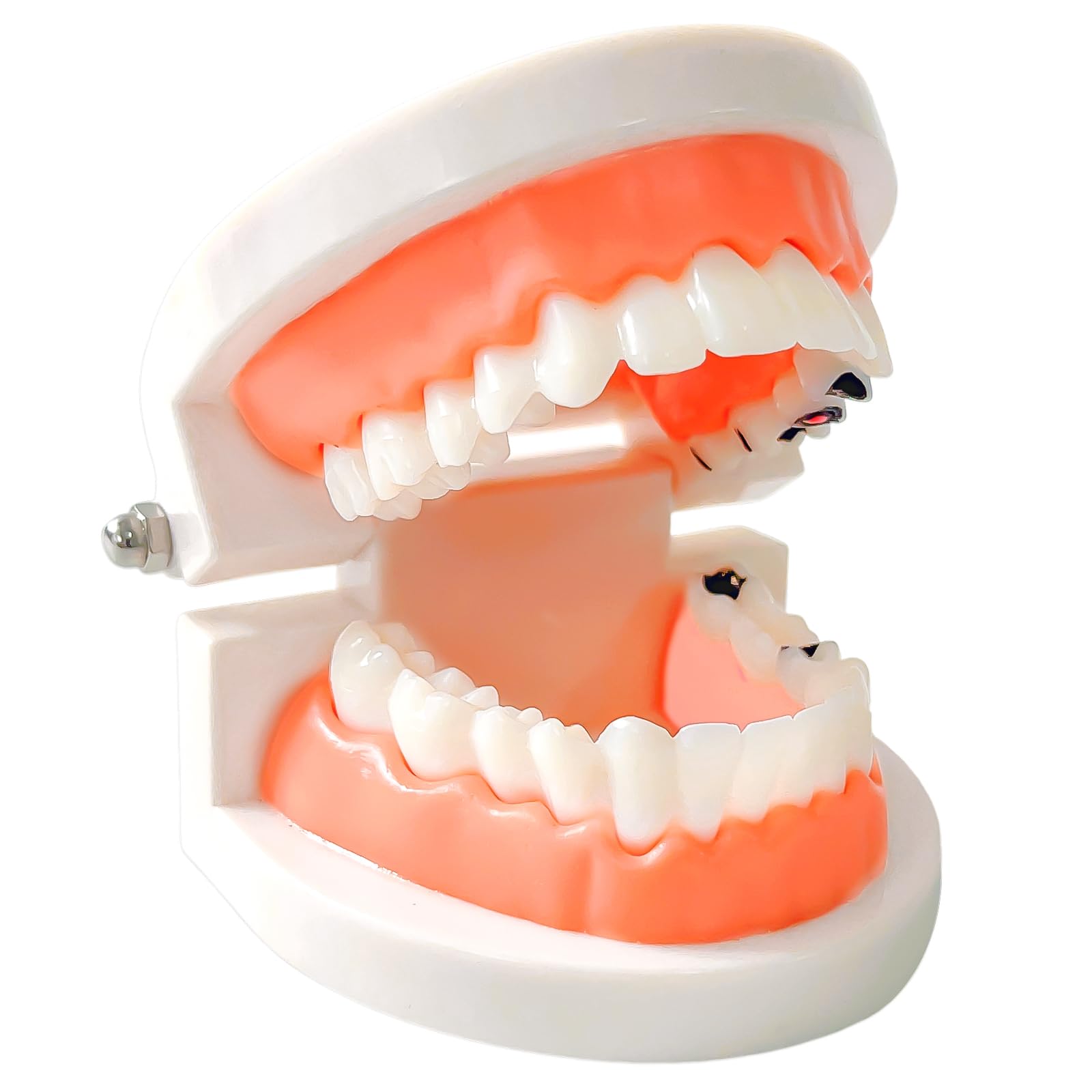 Dental Caries Teaching Model 1:1 Adult Life Size - Non-Removable Teeth Model for Education - Ideal for Demonstrations and Learning Dental Structures
