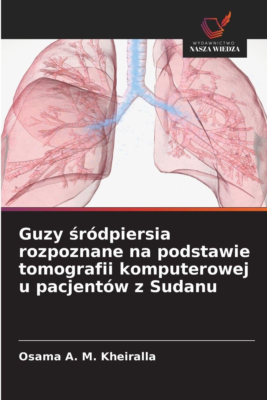 Guzy śródpiersia rozpoznane na podstawie tomografii komputerowej u pacjentów z Sudanu