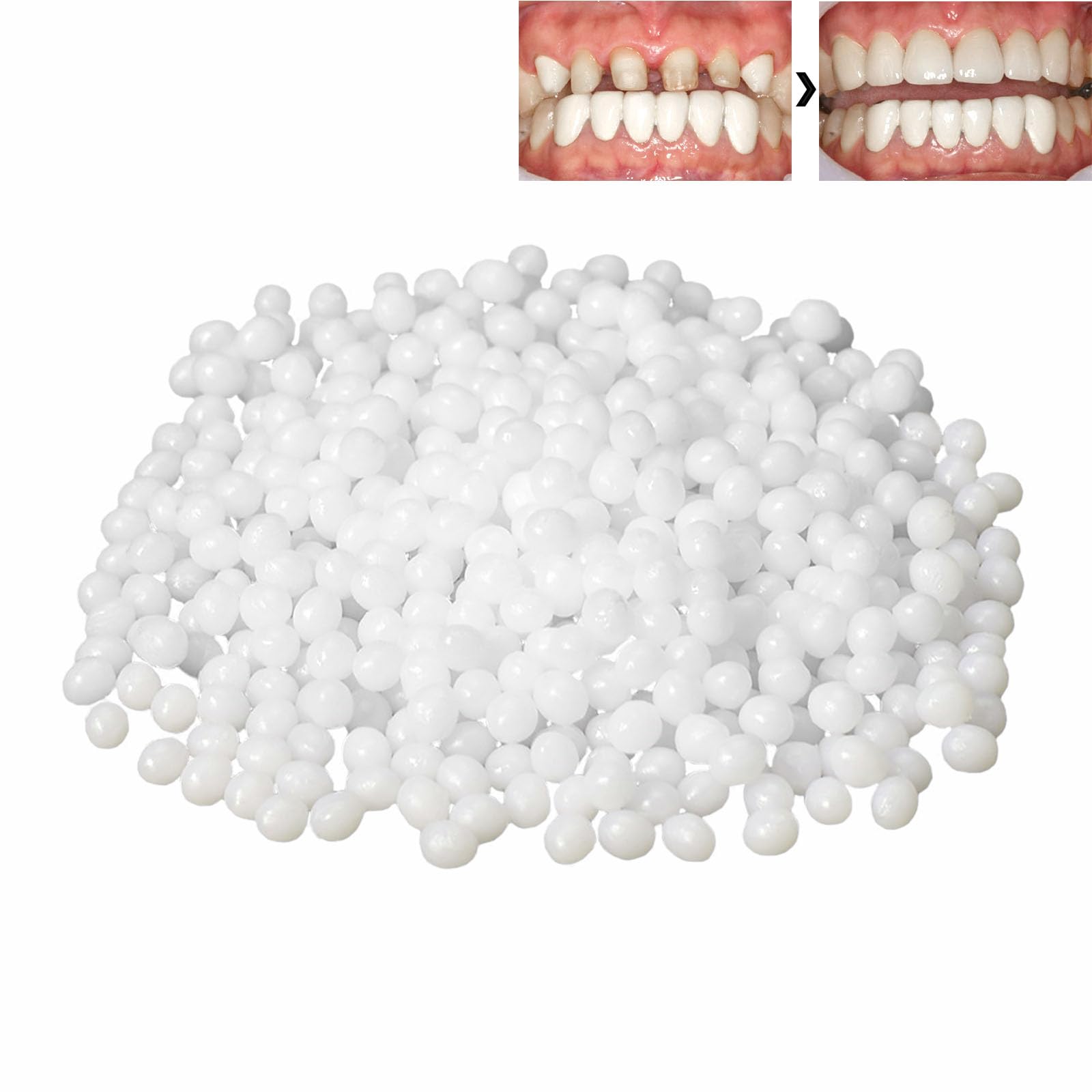 ALLVD 入れ歯歯科用樹脂仮歯修復キット欠けた歯を仮修復する仮義歯交換キット 交換義歯DIY サーマルフィットビーズ (袋入り5g)