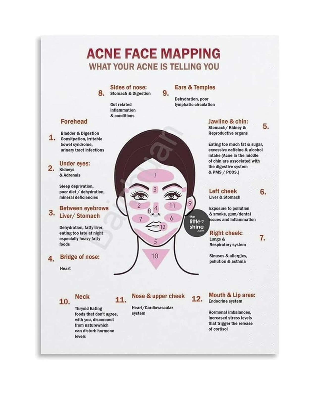 XGINERFEX Informational Facial Acne Chart Face Mapping Guide Canvas Print Wall-Art for Skincare Enthusiasts Bathroom Decor(Framed,12x18inch(30x45cm))