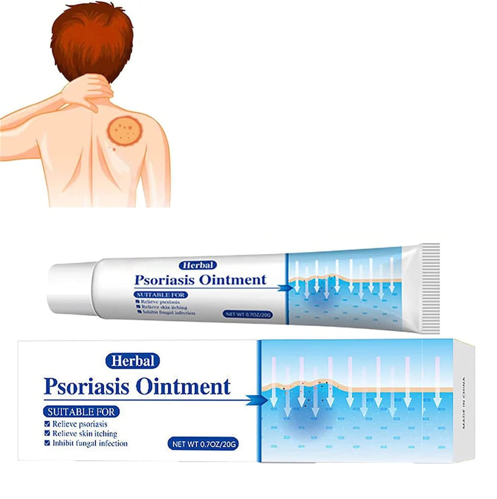 Buy 1/2/3 PCS KoTinea Soothing Ointment, KoTinea Psoriasis Cream