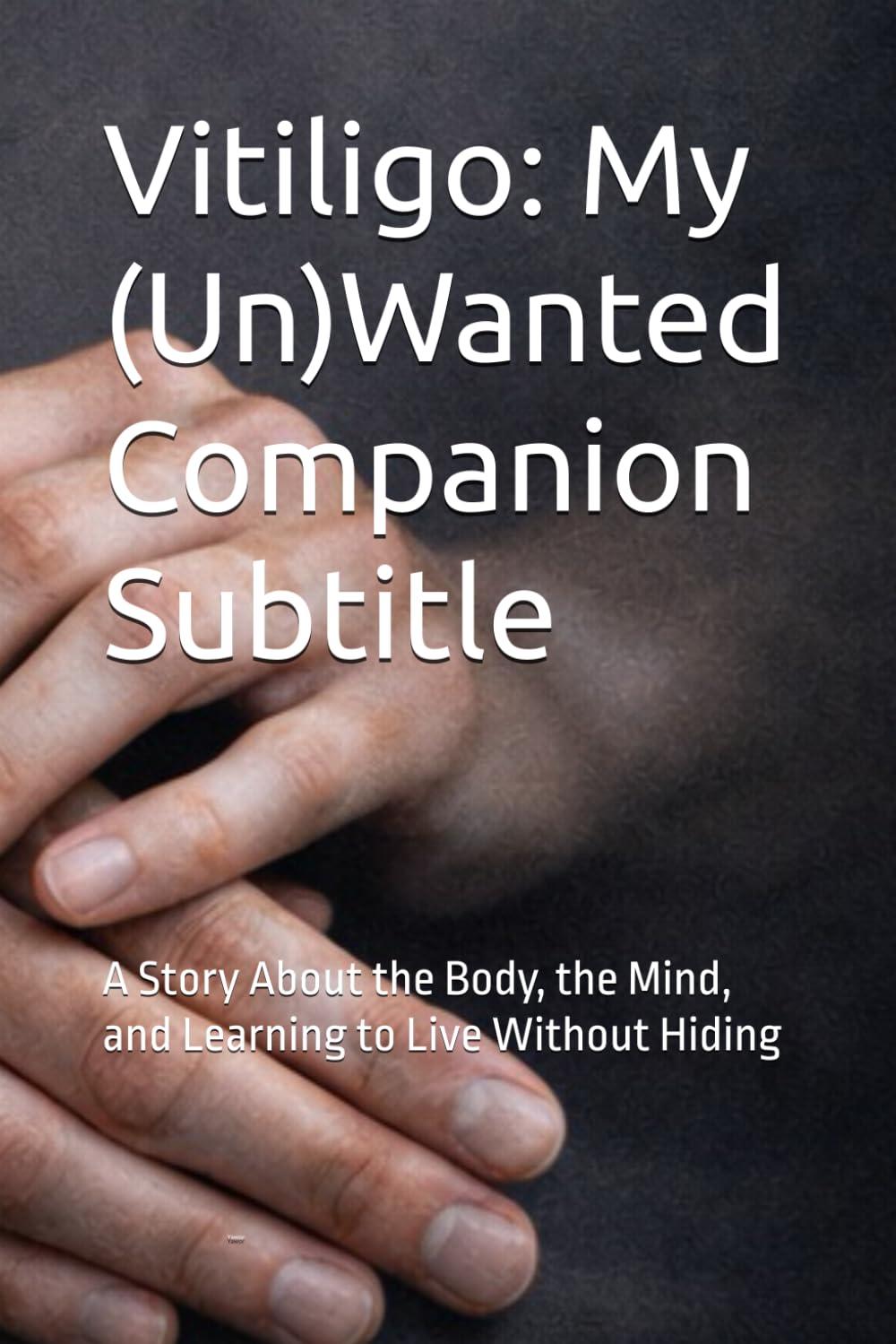 Vitiligo: My (Un)Wanted Companion Subtitle: A Story About the Body, the Mind, and Learning to Live Without Hiding