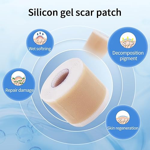 Miniatura 9 de Hojas médicas de silicona suave para cicatrices (1.6 x 59 pulgadas), eliminación de golpes queloides, rollo hidrocoloide para tratamiento de
