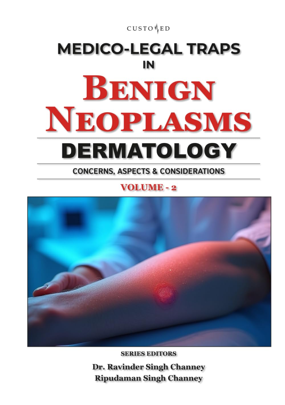 Medico-Legal Traps in Benign Neoplasms | Dermatology | Vol - 2 (MEDICO-LEGAL SERIES)