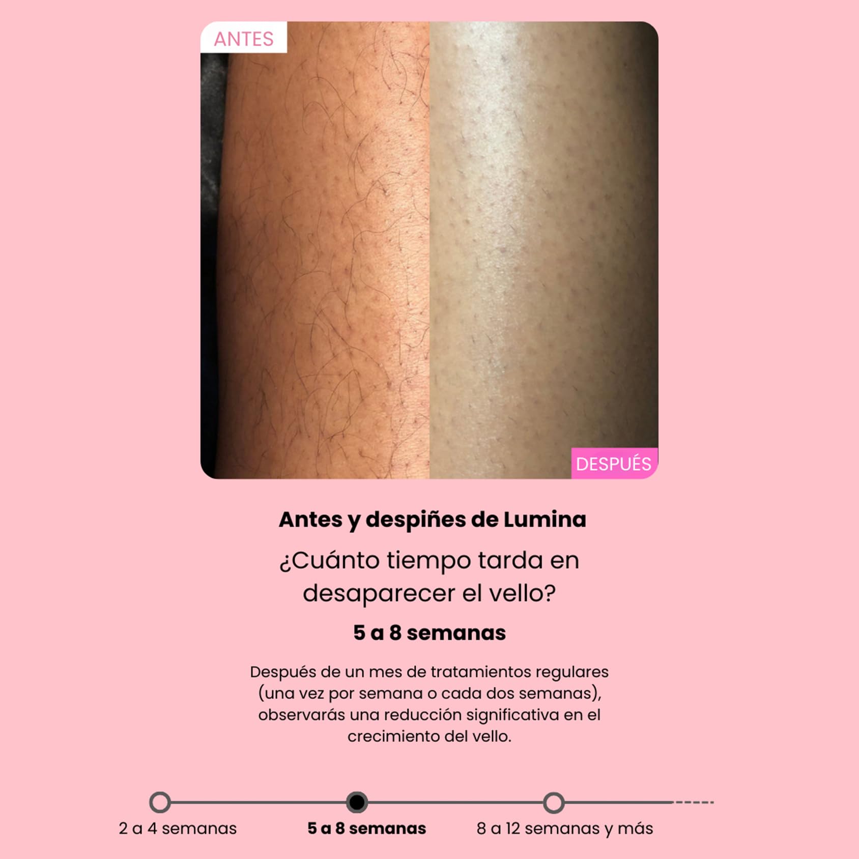 Depiladora, Tecnología IPL, Detiene el Crecimiento del Vello, Proporcionando una Piel Suave con una Sensación Delicada e Indolora(Lila Claro)