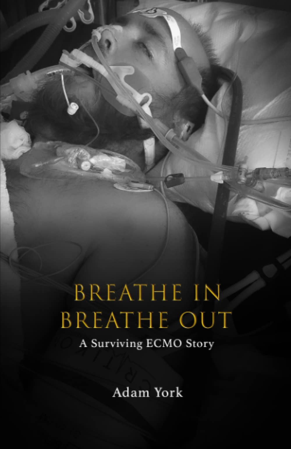 Breathe In Breathe Out: A Surviving ECMO Story