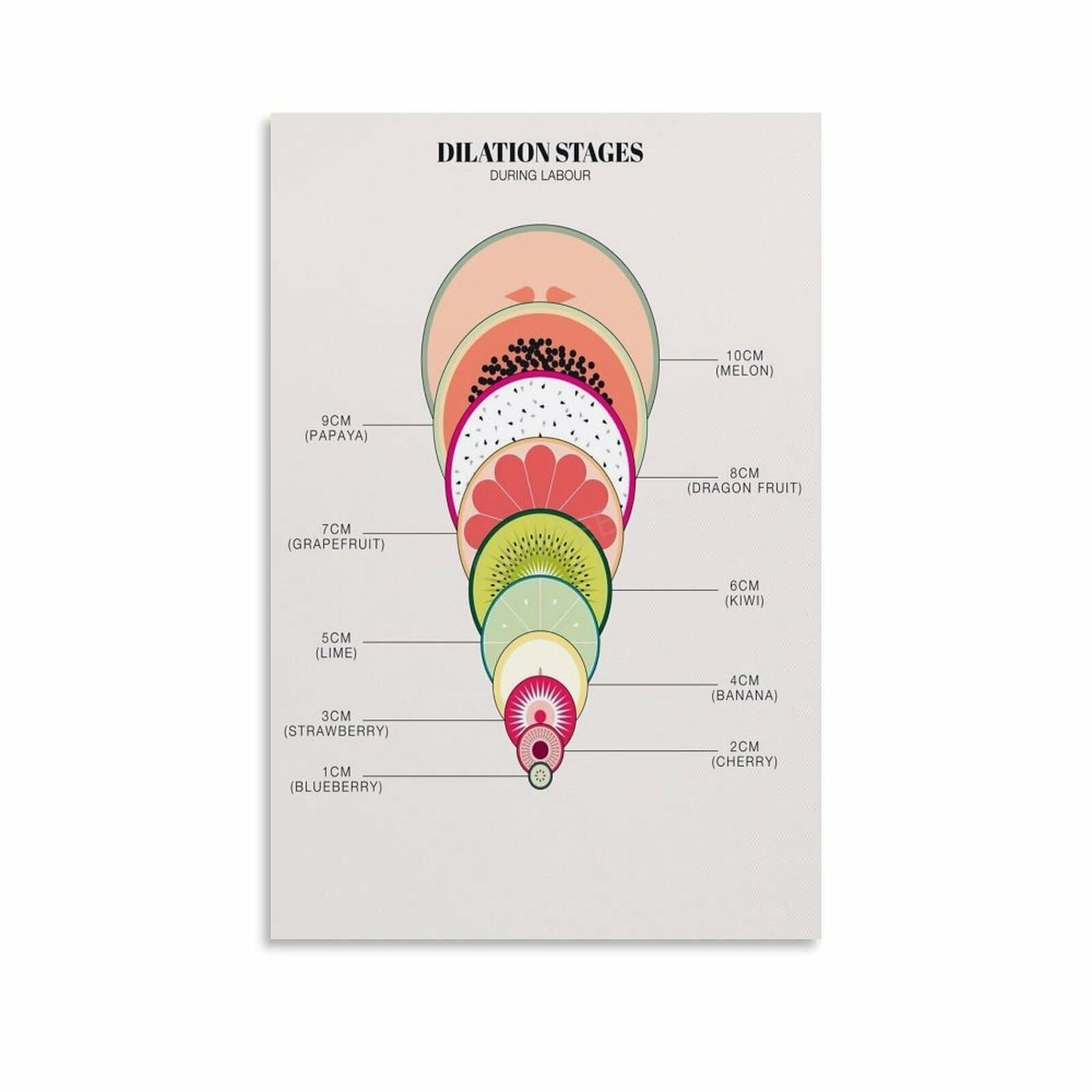 HGETJOHXEM Cervical Dilation Stages Educational Poster - Childbirth Birth Process Anatomy Chart for Midwives, Doulas & Nursing Students(Unframed,16x24inch(40x60cm))