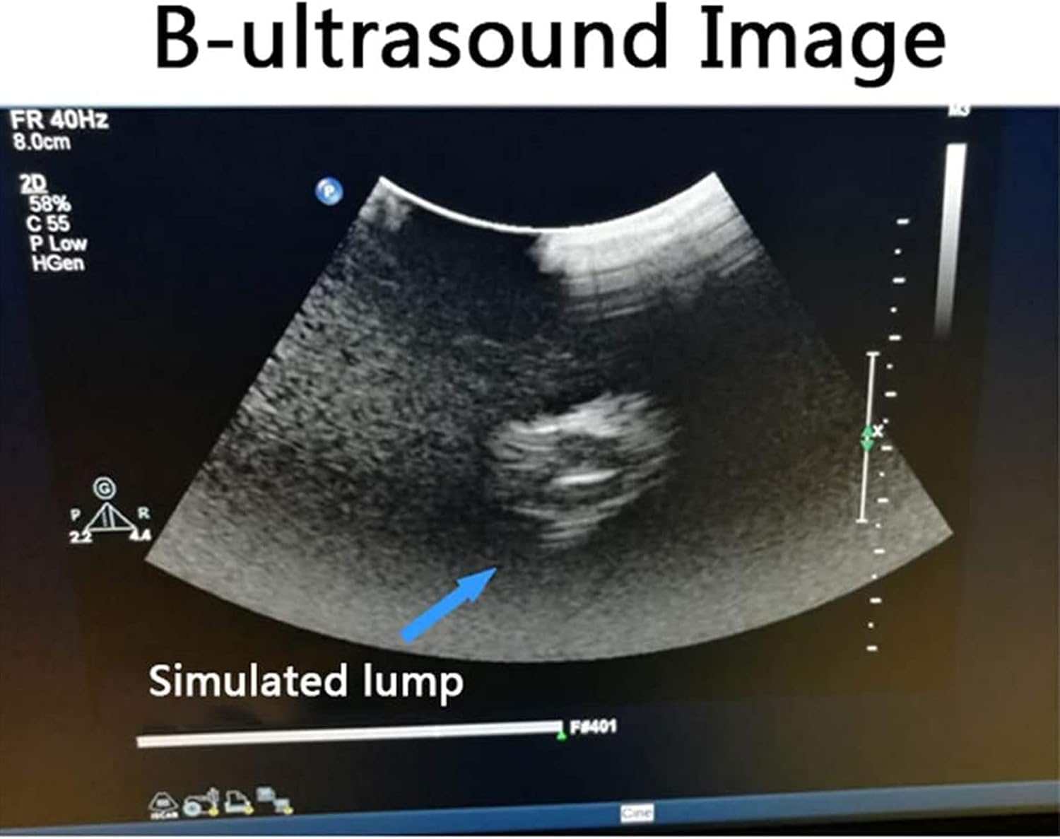 Modèle De Ponction par échographie B, Modèle De Formation à La Ponction, Il Y A 9 Bosses Simulées à L’intérieur du Tissu pour La Pratique De L’enseignement des Soins Infirmiers