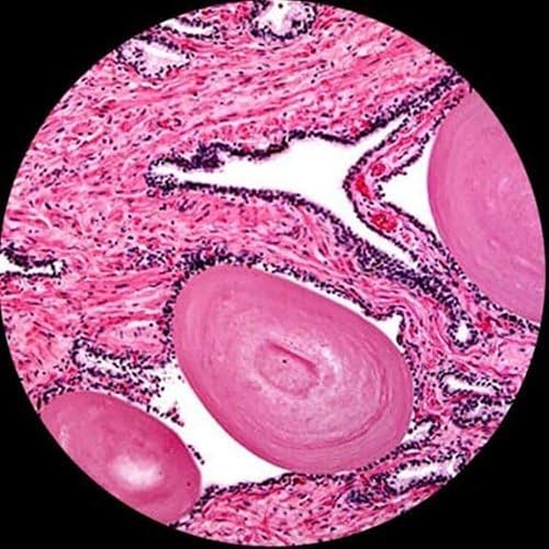 Vista 15 de AmScope Microscopio compuesto trinocular Siedentopf profesional T120B, aumento 40X-2000X, oculares WF10x y WF20x, Brightfield, iluminación LED