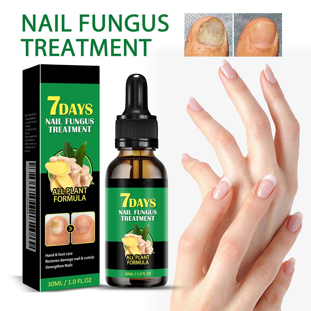 Siero per Unghie allo Zenzero da 30 ml, Siero per Unghie Rinforzante e Riparatore, Olio per Unghie allo Zenzero per Rafforzare le Unghie