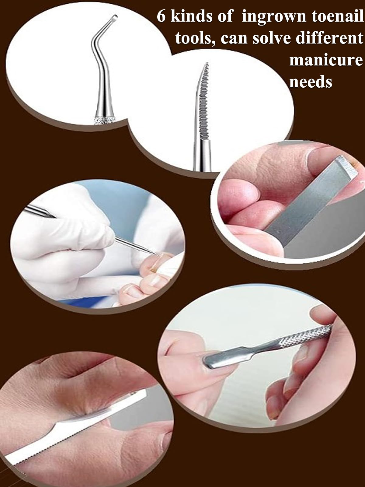 Ongle Incarné Kit, Pedicure Professionnel pour Pied Kit de Correction D'ongles Incarnés Coupe Ongle Pied Kit de Soin des Pieds en Acier Inoxydable Professionnel