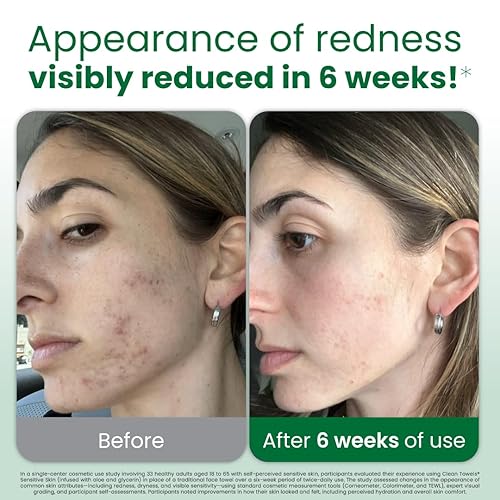 Miniatura 2 de Toallas limpias para pieles sensibles XL (50 unidades)