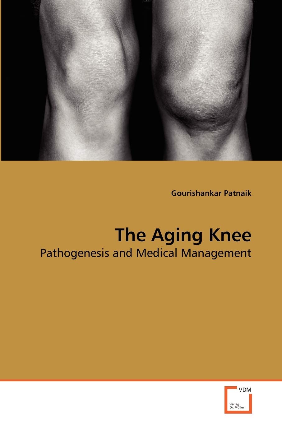 The Aging Knee: Pathogenesis and Medical Management