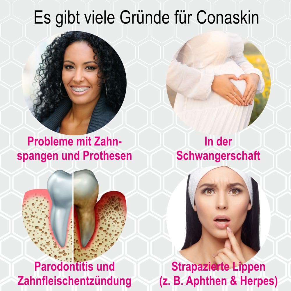 Mundpflege-Tinktur MANUKA-HONIG (MGO400) PROPOLIS | Naturkosmetik | Druckstellen durch Zahnspangen | Bei Zahnfleischentzündung Herpes Aphten