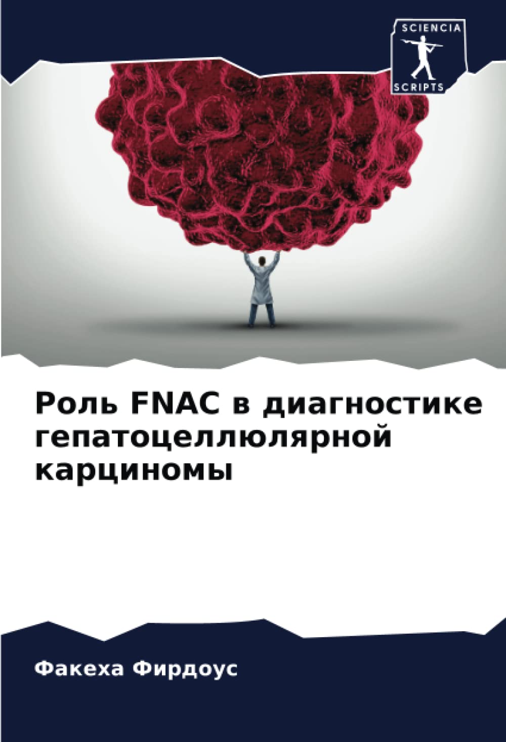 Роль FNAC в диагностике гепатоцеллюлярной карциномы