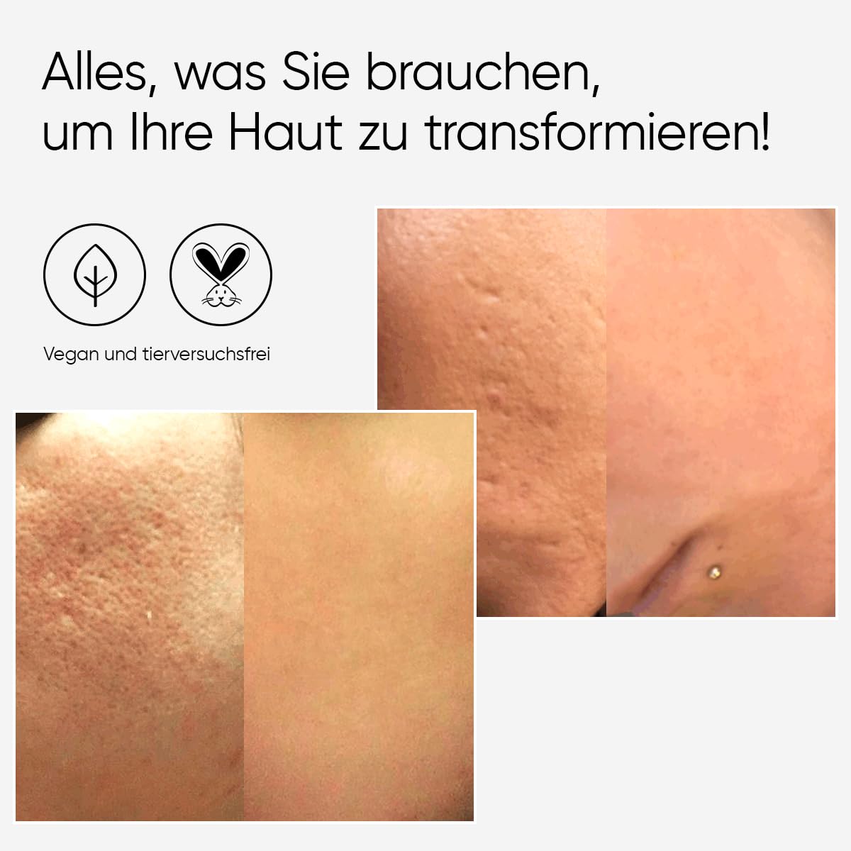 âme pure® CIT Face Roller Basic zestaw w 100% naturalny mikroigiełkowy do pielęgnacji skóry wrażliwej, zapewnia idealnie promienny wygląd skóry bez zmarszczek i zanieczyszczeń (0,5 mm)
